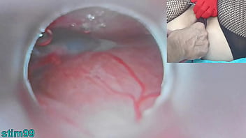 Japanese uterus creampie with cum, cervix cam, uterine exploration, uncensored womb invasion