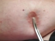 Nipple Torture