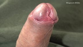 My Foreskin Penis and Loose Asshole 2026 #05