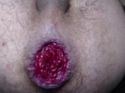 Punch fisting, prolapse and cumming real good