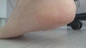 DRY AND WRINKLY SOLES (pov)