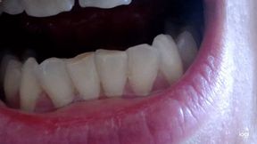 13 minutes of down side teeth to cam mp4