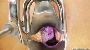 Gaped vagina of hot tempered granny Simira gets stretched with speculum