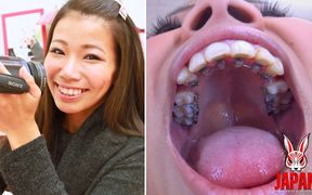 Orthodontic Teeth Fetish: Izumi Asato's Dental Fantasy