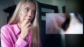 Endoscope in my nose ENDOSCOPE DAY mp4 FULL HD