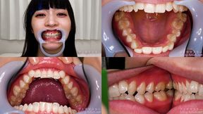 Meru Adachi - Watching Inside mouth of Japanese cute girl - 1080p