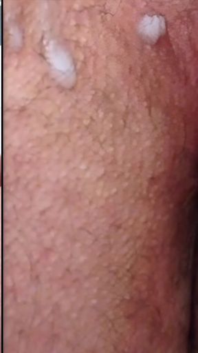 Split-screen Twitching Asshole Dripping with Massive Cum Load