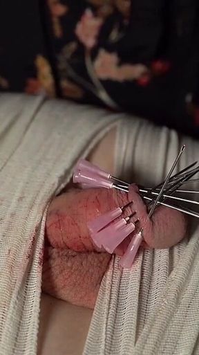 A Crown of Needles, the Only Crown You Will Ever Wear!