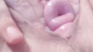Cervix performance plowed and pump