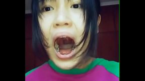 Asian Girl Showing her Teeth Cavities
