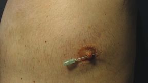 Nipple needle pain