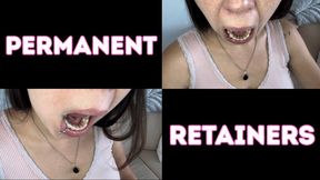 Permanent retainer sexy mouth tour