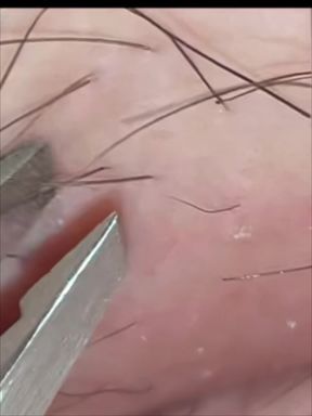 Hints to Detailed Smoothness