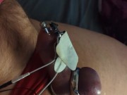 Metal ring estim