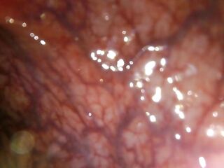 POV: Gulping you into the tip of my transverse