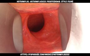 Deep penetration of her anus with large speculum and massive dildo