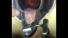 Sp&eacute_culum and cum