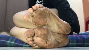 Dirty feet with lotion