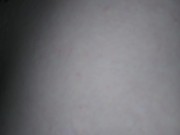 Pre Op Trans Man, Big Nipples Clothes Pin Clamped