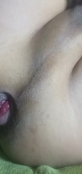 Hands-Free Anal Masturbation, Small Prolapse and Shoeing