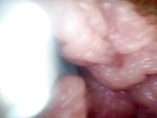 Endoscope camera shows the almost any sensitive parts of the jock Educational movie scene