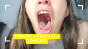 My tonsils are inflamed and diseased