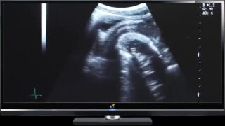 Koppel, zonder condoom, penissen, dokter, medisch – mannen met grote piemels die anaal seks hebben