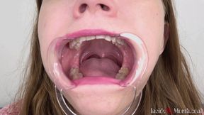 Inside My Mouth - Lola (HD)