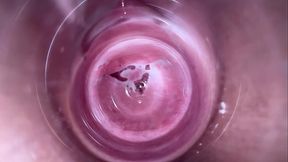 Camera deep inside teen creamy vagina