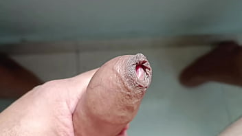 Quitando el prepucio 1