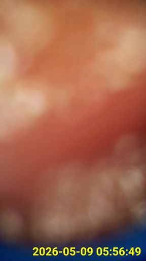 Close up of buttplug &amp; HD Endoscope insertion
