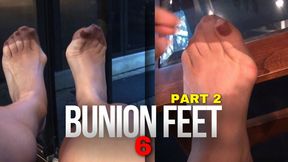 Fetish208 - Foot Fantasies, Bunion Feet 6, Part 2