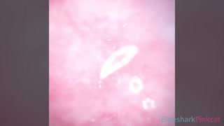 Camera inside Vagina after internal Creampie EP2