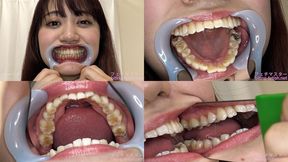 Yukino - Watching Inside mouth of Japanese cute girl bite-261-1 - 1080p