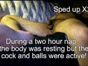 Nocturnal Erections