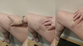 i love playing with my bruises and seeing the way the colours change when you poke them