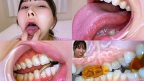 Kana Yura - Special Project - Even More Revealing Special Inside Oral Observation & Oral Fetish Play
