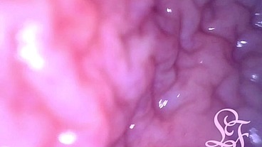 INSIDE POV: Inflating my Bladder with Air!