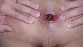 cuzinho com surpresinha no fundindo