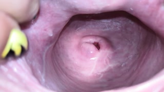 Cervix close up [4k]