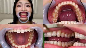 Yuina Taki - Watching Inside mouth of Japanese cute girl - MOV