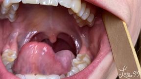 Mouth, teeth, tongue, uvula exploration full HD mp4