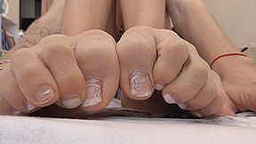 Terrible scabby toes! MP4