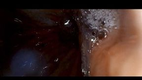 Endoscópica camera (view stomach)