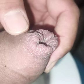 The silver of my penis is not coming up