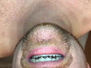 Inserting My Own Cum Filled Night Guard Into My Mouth Before Bedtime So I Can Taste Sperm All Night
