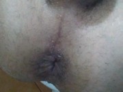 Trans girl anal extrem. Creampie anal a chorros y prolapso.