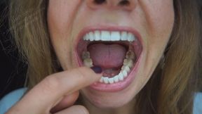 Mouth Tour