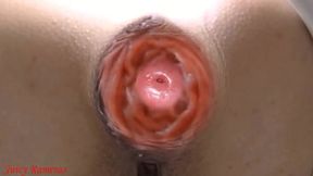 Public toilet peep: Anal&#x1F44C; fuck slut gets prolapse pee cumshot