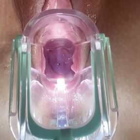 Stella St. Rose - Extreme Gaping, See my Cervix Close-Up using a Speculum